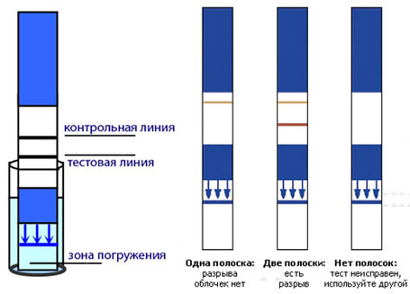 Положительный Тест На Подтекание Околоплодных Вод Фото